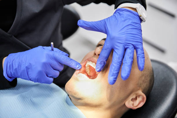 Best Emergency Broken Tooth Repair in Hidden Hills, CA